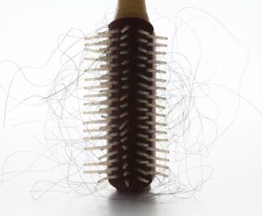 The 9 Best Hair-Loss Treatments for Men, According to Dermatologists