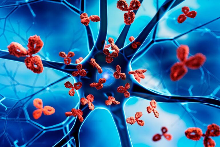 Argonaut Manufacturing