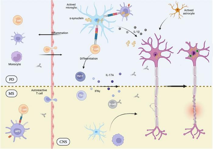 Shared immune features in Parkinson's disease and multiple sclerosis