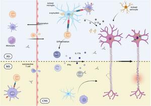 Rethinking Parkinson's: Immune insights from brain-resident and peripheral cells offer new therapeutic hopes