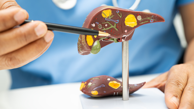 A Journey from Liver Cirrhosis to Complete Wellness through Yoga and Pranayama