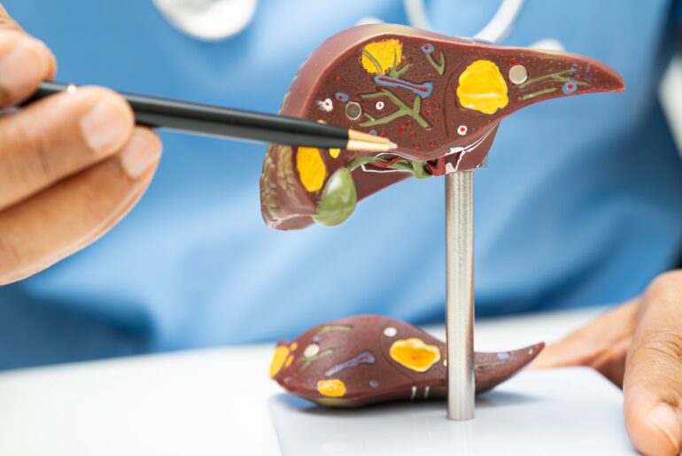 A Journey from Liver Cirrhosis to Complete Wellness through Yoga and Pranayama