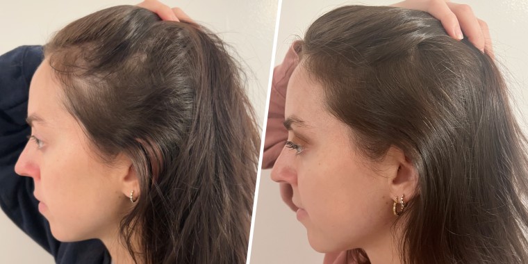 Before (left) and after (right)