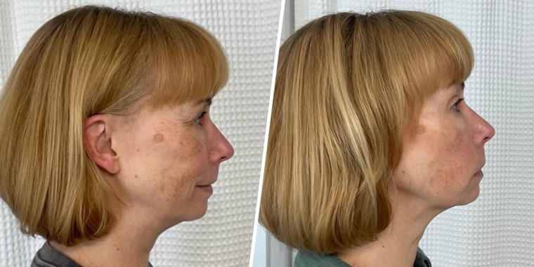 Before (left) and after (right)