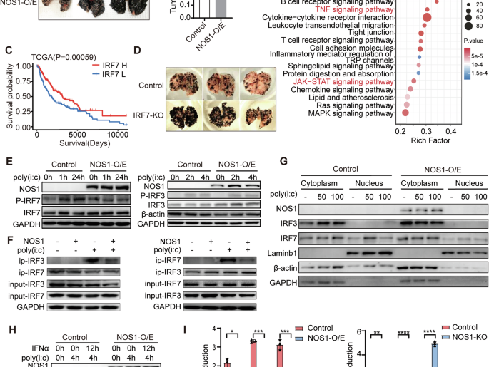 S-nitrosylation of IRF7 induced by NOS1 expression in melanoma suppresses anti-tumor immunity