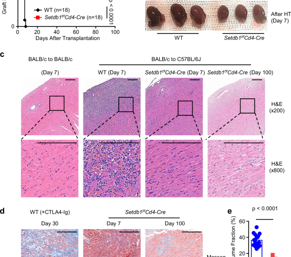 Targeting Setdb1 in T cells induces transplant tolerance without compromising antitumor immunity