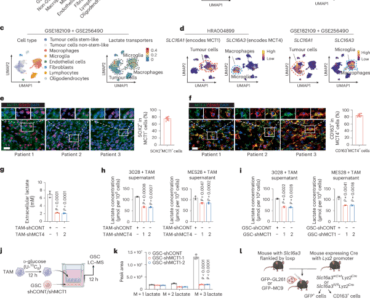 Inhibiting macrophage-derived lactate transport restores cGAS–STING signalling and enhances antitumour immunity in glioblastoma
