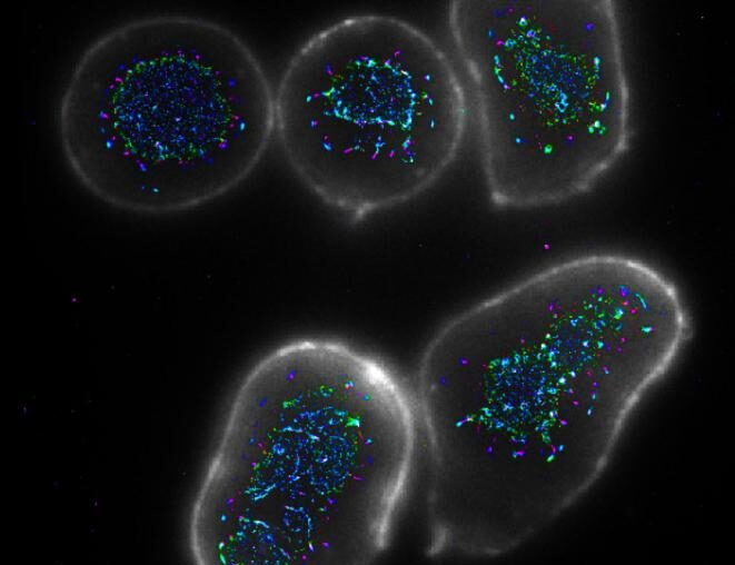 Researchers find new way to boost immune response to cancer