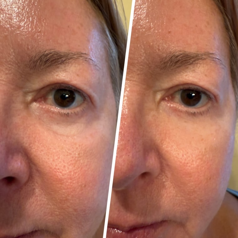 Before (left) and after (right)