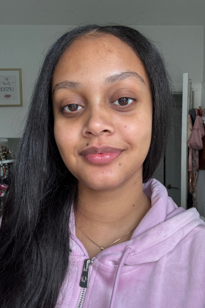 Shauna Beni-Haynes before and after testing Face Reality's HydraRemedy Gel Serum