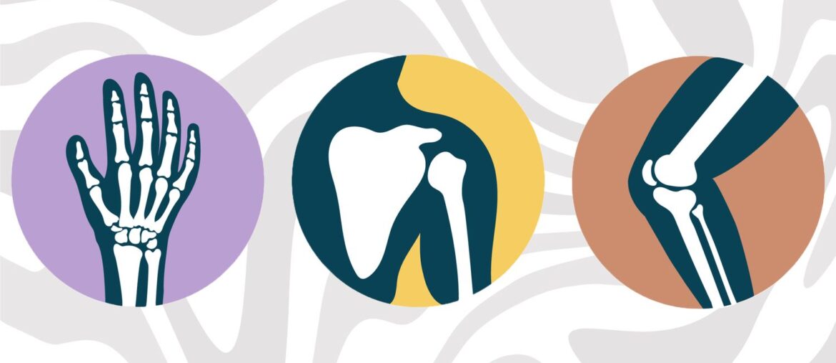 What Happens to Your Bones When You Take Calcium