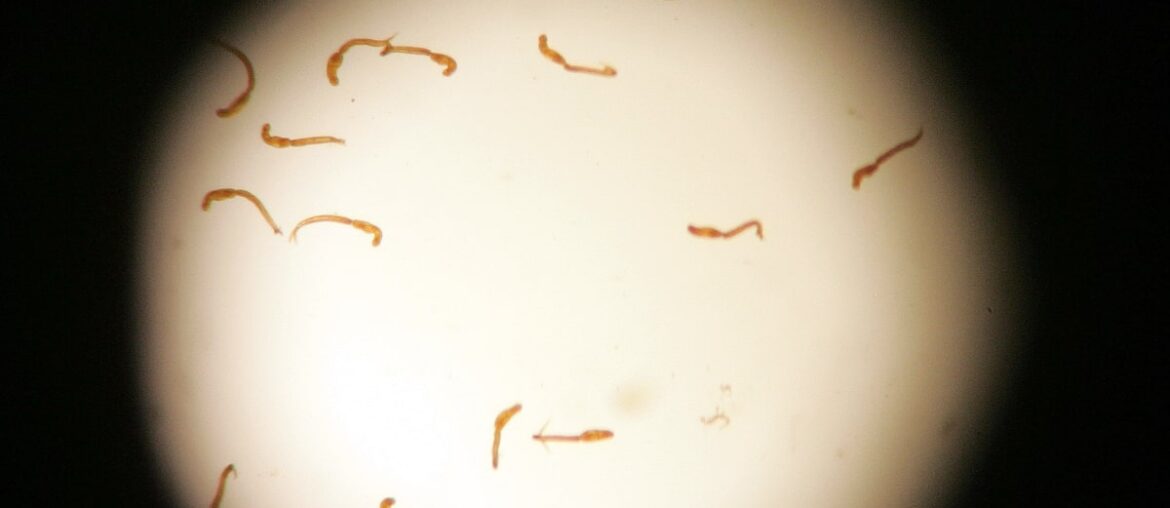 Humans can’t make vitamin C. A parasite may explain why