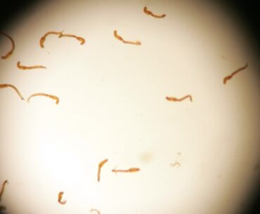 Humans can’t make vitamin C. A parasite may explain why