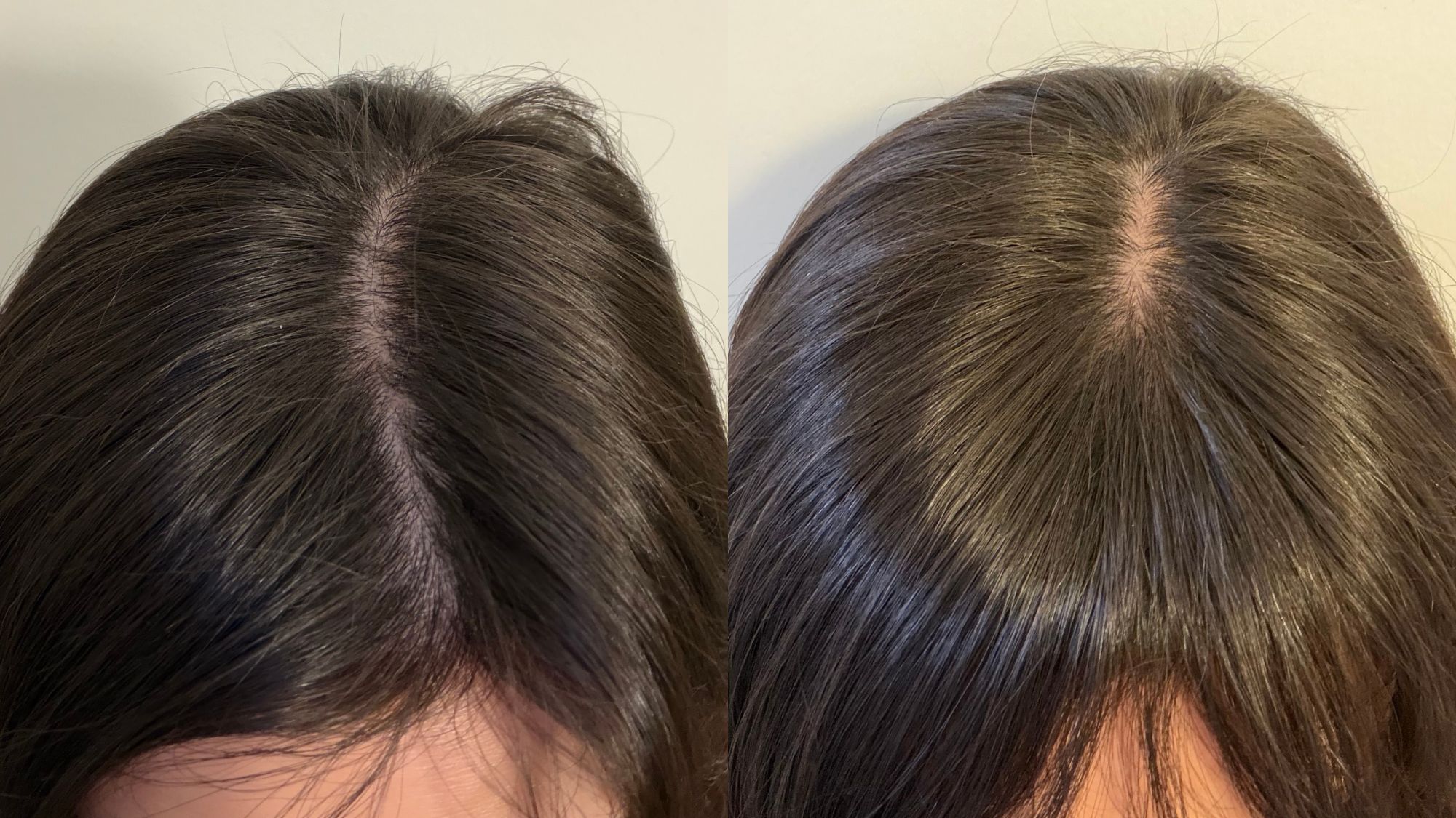 An image of Brascia's hair before and after washing with the Briogeo Scalp Revival Dandruff Relief Shampoo and Conditioner.