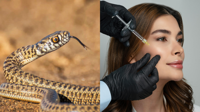 Beauty clinics to emergency rooms: Botox could help treat snakebites