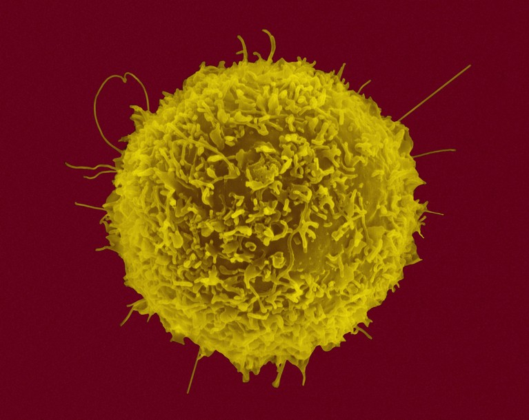 A coloured scanning electron micrograph of a single human T lymphocyte.