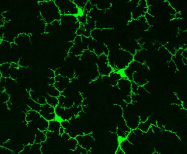 Refreshing the Brain’s Immune Cells Could Treat a Host of Diseases