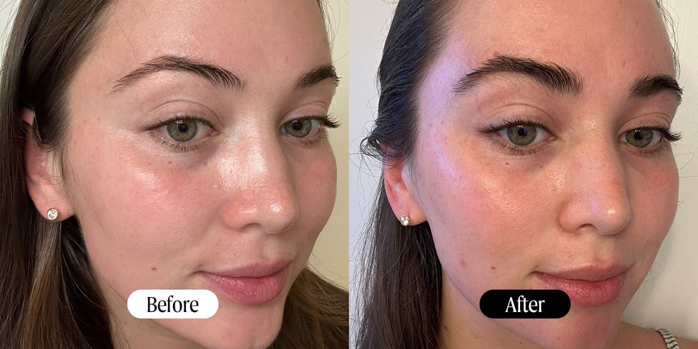 obagi brow serum before after