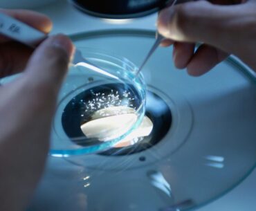 Brain Parasite Infects Immune Cells: Why It's OK