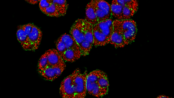 How food shortages reprogram immune system response