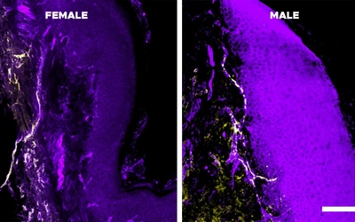 A side-by-side comparison of male versus female cells.