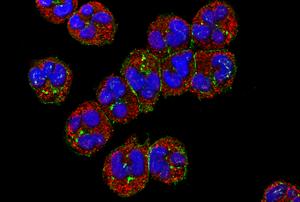 How food shortages reprogram the immune system’s response to infection