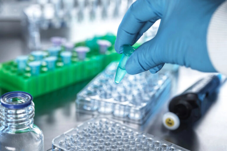 Research identifies a distinct immune signature in treatment-resistant Myasthenia Gravis