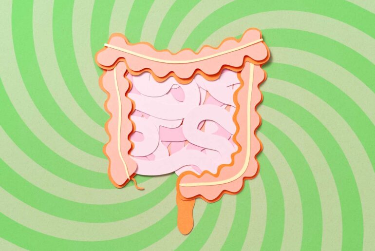 4 Supplements to Avoid If You Have Ulcerative Colitis