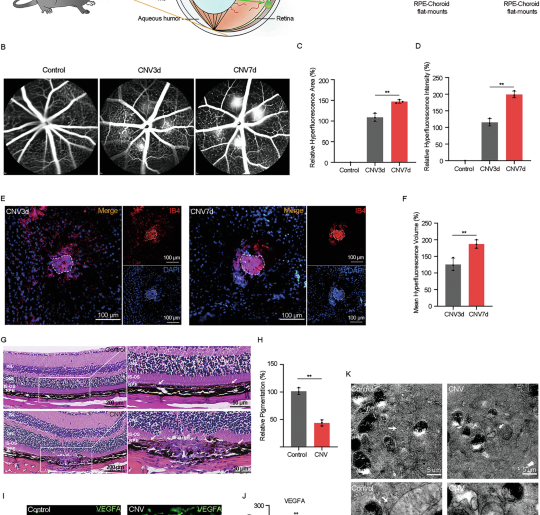 The role of vitamin K and its antagonist in the process of ferroptosis-damaged RPE-mediated CNV