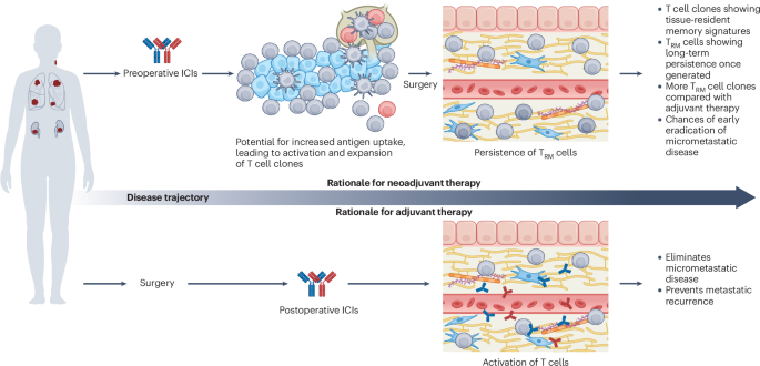 Reconsidering adjuvant and perioperative immune-checkpoint inhibition: de-escalation, expansion and personalization