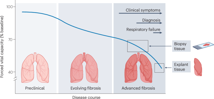 Fibroblasts as regulators of lung immunity, repair and fibrosis
