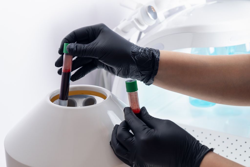 therapeutic plasma exchange 