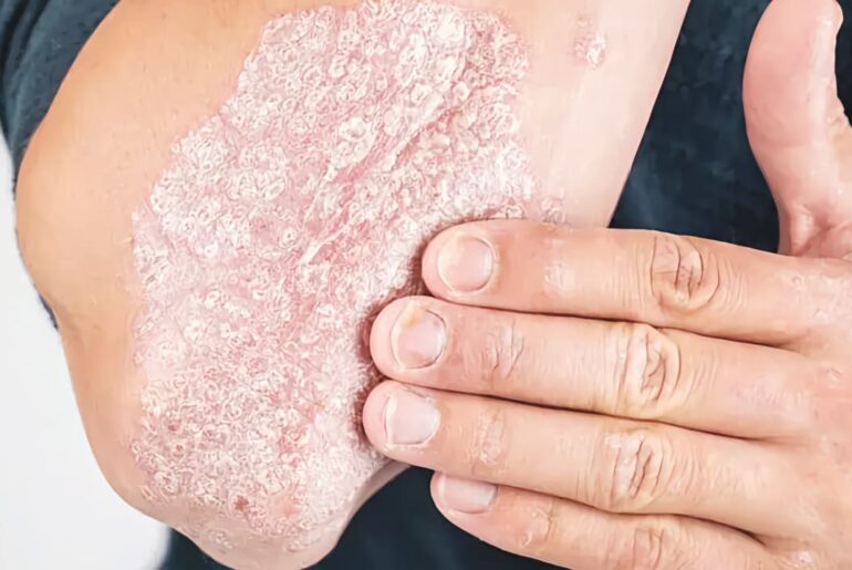 The Jerusalem Post - Israel News