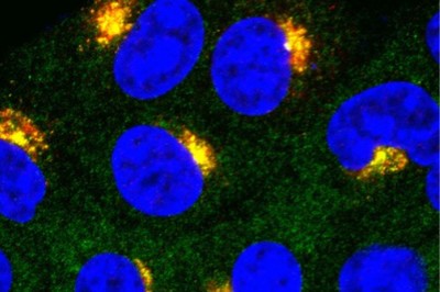 Studies Identify Lipids Necessary for Immune Molecule Activation