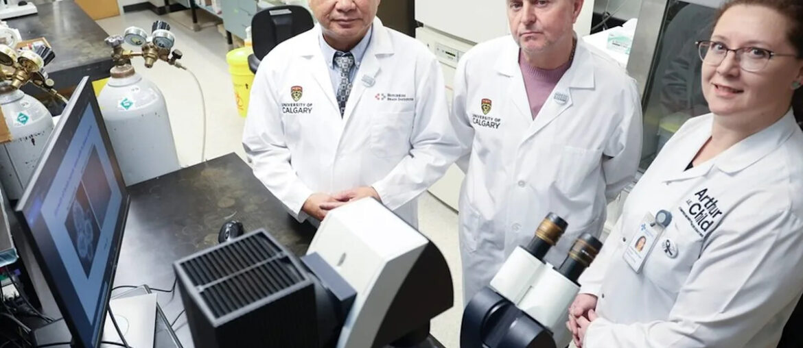 Vitamin B3 shows promise in halting brain cancer's return: U of C researchers