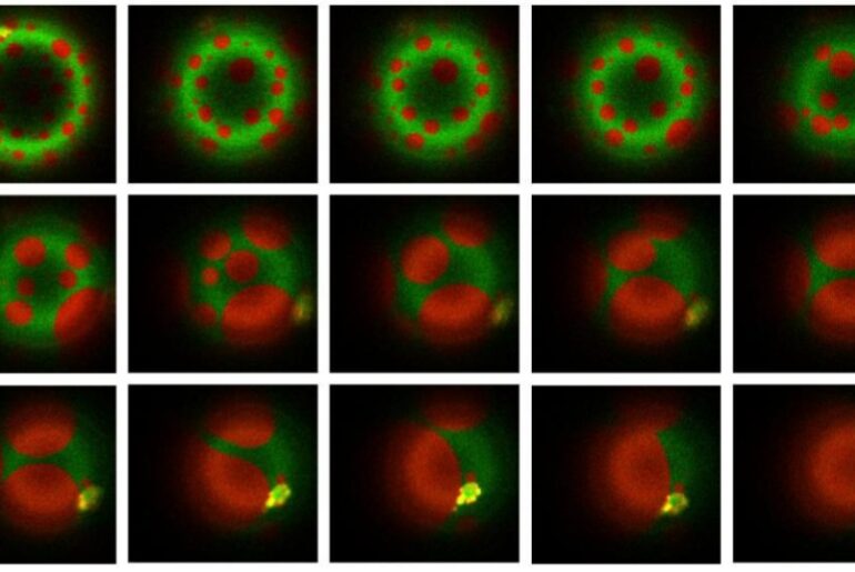 Mycobacteria have evolved sophisticated ways to hijack human immune cells and avoid being destroyed. Specifically, they stiffen the internal membrane to prevent the digestive enzymes within lysosomes from destroying the bacteria.