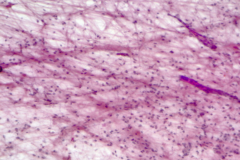 Ben-Gurion University Study Finds Skin Gene Also Powers the Body’s Frontline Immune Defense