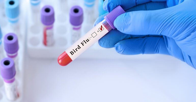 positive test for bird flu