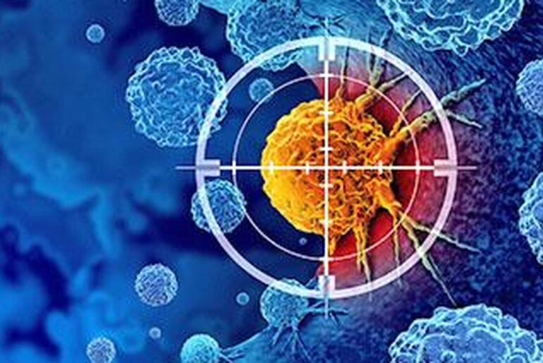 Study by Indian researchers finds that body’s immune cells ‘betray’ it to help breast cancer spread