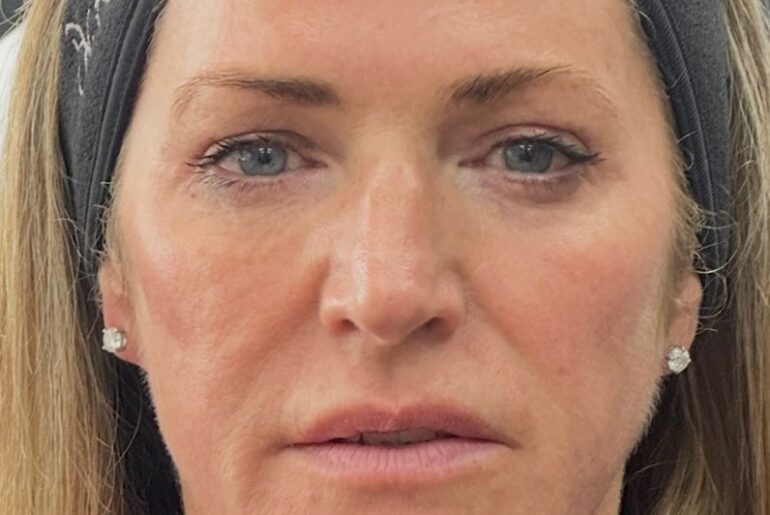 ‘Biostimvesting’: 2026’s Biggest Beauty Shift