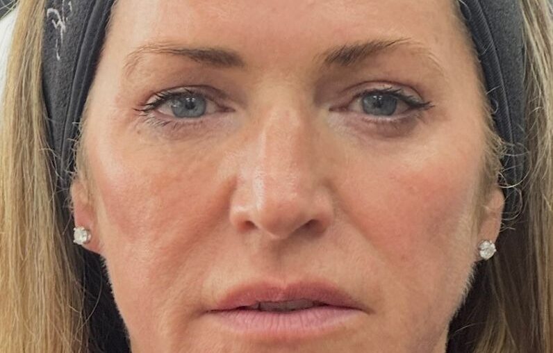 ‘Biostimvesting’: 2026’s Biggest Beauty Shift