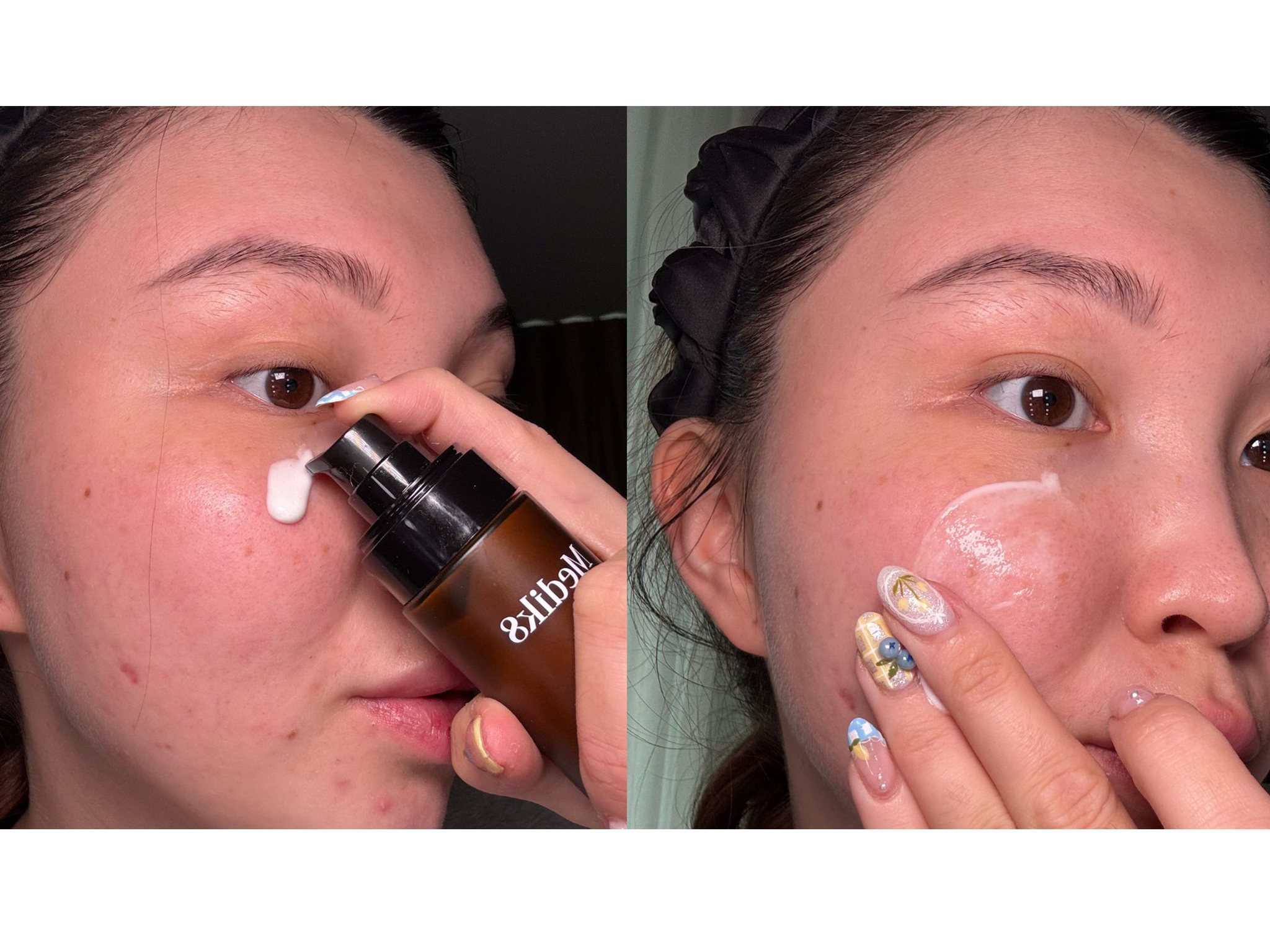 I applied the serum every morning over the course of four weeks