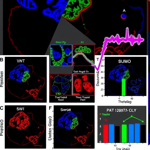 SUMOylation Drives Immune Dysregulation in Regulatory T Cells