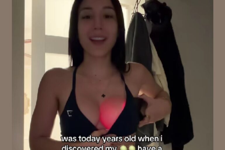 Fitness Influencer's Implants Have Strange Effect With a Flashlight