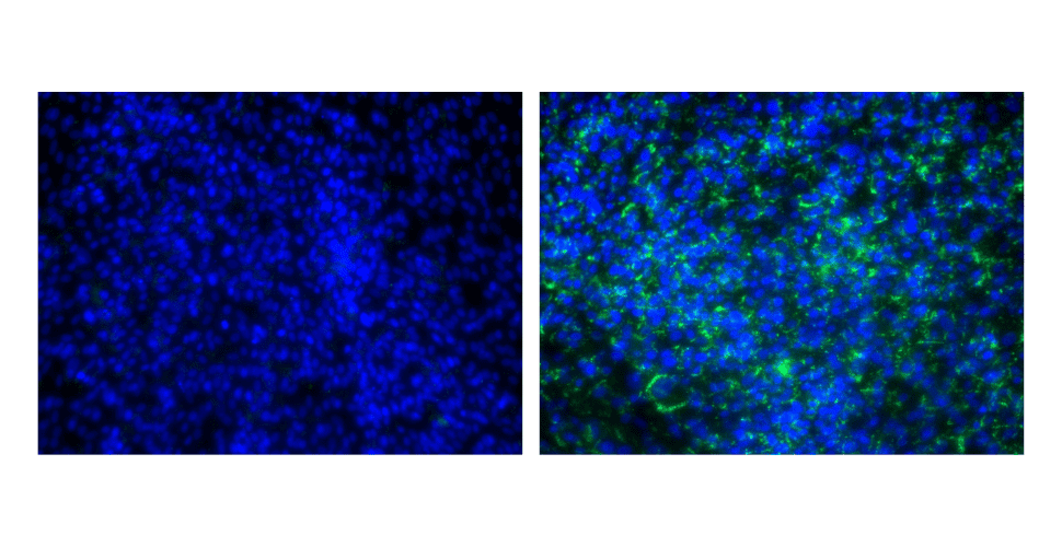 Fluorescence images of bovine cells under normal culture conditions (left) and after adipogenic differentiation (right). Intracellular lipid droplets were stained green (BODIPY) and cell nuclei blue (DAPI).