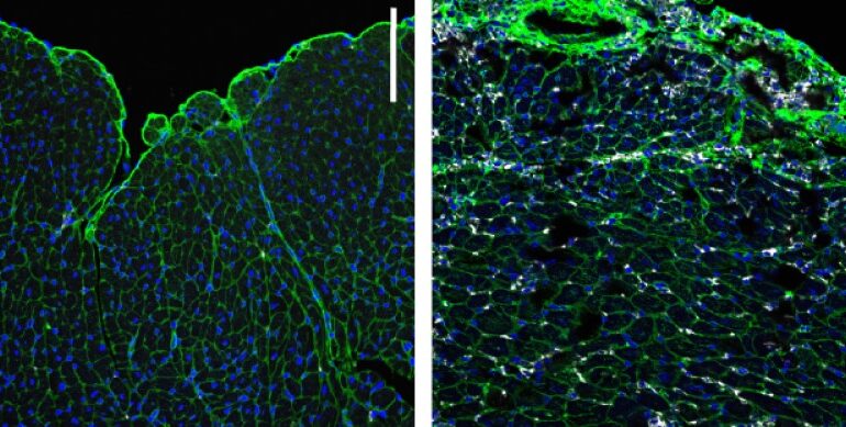 Discovery Could Make Immune Checkpoint Inhibitors Safer