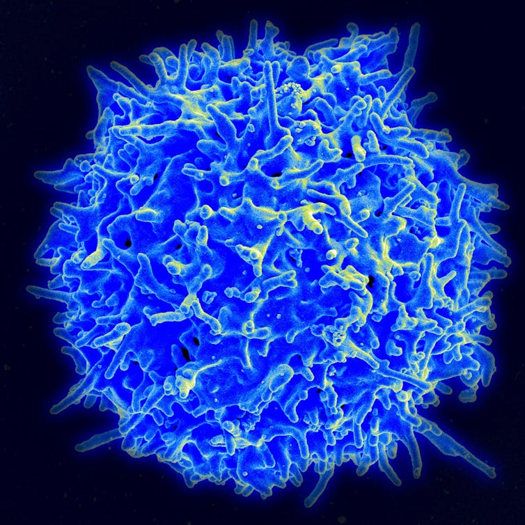 A bright blue cell.