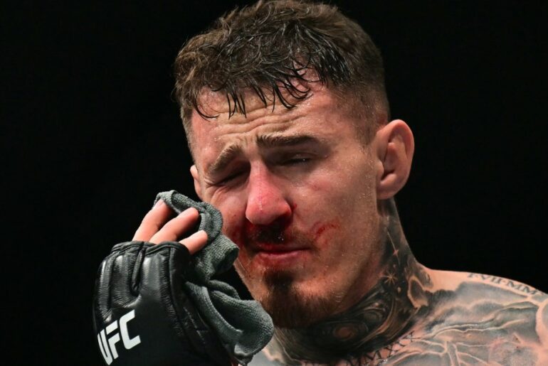 Tom Aspinall undergoes surgery on both eyes, doctors working to get his ‘vision back to fighting fitness’