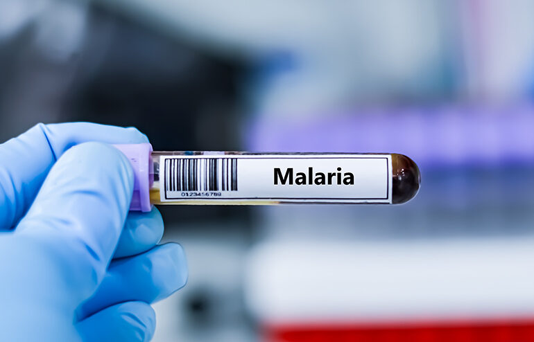 Study reveals immune blueprint for next-generation malaria vaccine  