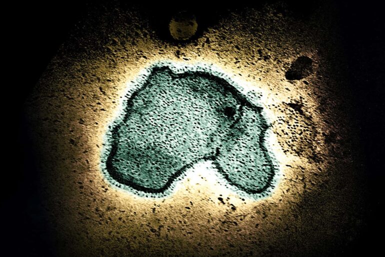 Infant Immune Response Differs Between RSV and SARS-CoV-2